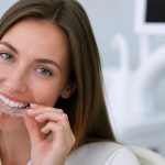 Paciente a utilizar alinhadores transparentes para corrigir o alinhamento dos dentes